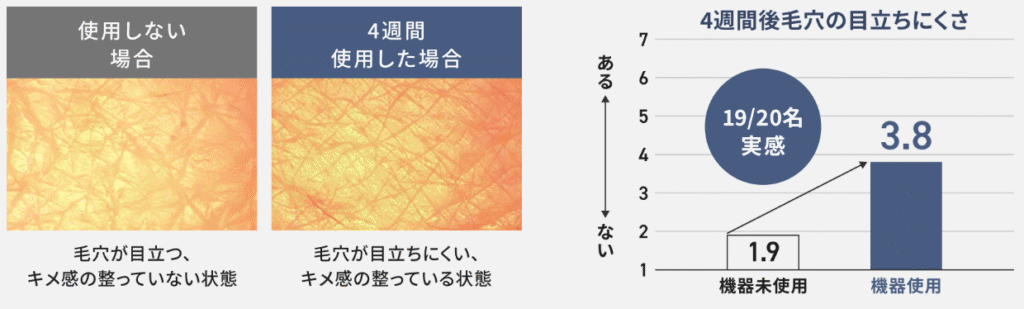 4週間バイタリフトRFを使用した場合