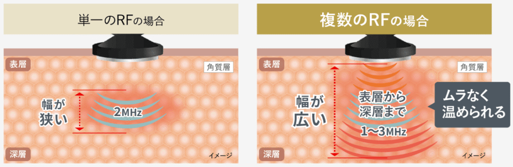 トリプルRFの効果