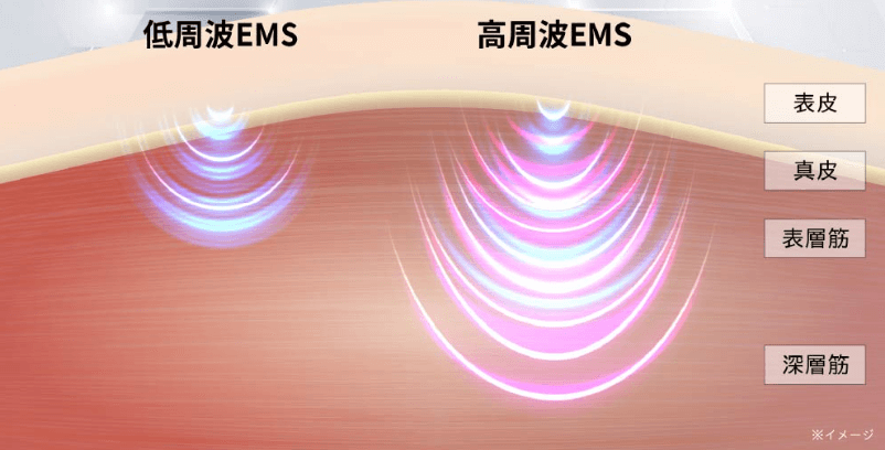 高周波・低周波EMS