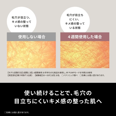 バイタリフトRF EXの特長