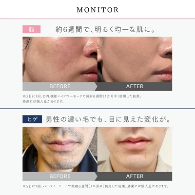 マイトレックスミライの特長
