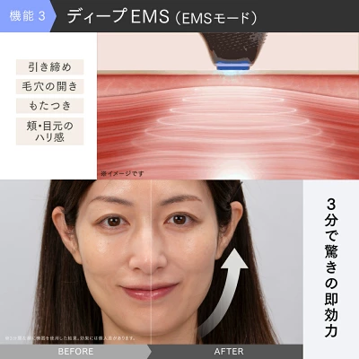 マイトレックスミライワンの特長