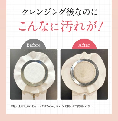 マルチフェイシャルスパの特長